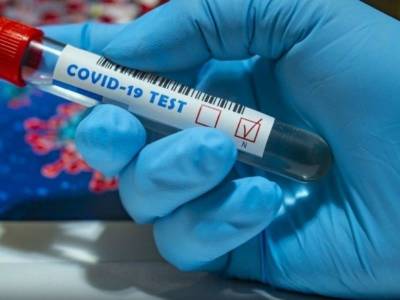 Какие существуют тесты на коронавирус и как правильно пройти обследование на COVID-19 - bloknot.ru - Россия