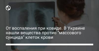От воспаления при ковиде. В Украине нашли вещества против "массового суицида" клеток крови - liga.net - Украина