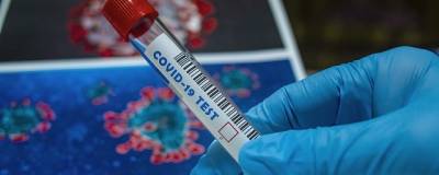 В Новосибирской области за сутки от коронавируса скончались 13 человек - runews24.ru - Новосибирская обл.