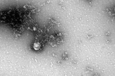 Впервые опубликованы фотографии «дельта»-штамма коронавируса - lenta.ru