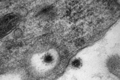 Ученые опубликовали фотографии дельта-штамма Covid-19 - tver.mk.ru - Индия
