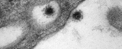 Центр «Вектор» впервые опубликовал фото дельта-штамма SARS-CoV-2, снятое на электронный микроскоп - runews24.ru