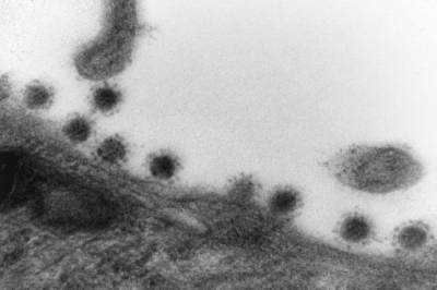 Опубликованы первые фото дельта-штамма коронавируса - aif.ru