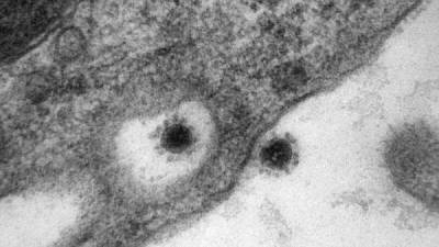 Как выглядит дельта-штамм коронавируса - skuke.net - Россия - Китай - Индия