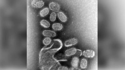 Штамм гриппа В/Yamagata мог полностью исчезнуть на фоне пандемии коронавируса - inforeactor.ru - Мельбурн