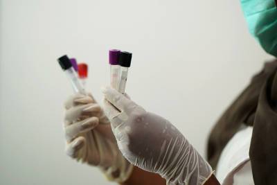 Более 640 тысяч тестов на коронавирус провели медики в Смоленской области - mk-smolensk.ru - Смоленская обл.