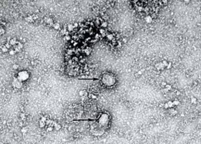 Дельта-штамм коронавируса существенно не отличается от других - CDC - nakanune.ru