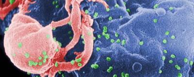 Организм человека подавляет ВИЧ двумя способами после пройденной терапии - runews24.ru