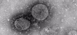 Раздведка США заявила, что коронавирус не был создан как биологическое оружие - finanz.ru - Сша