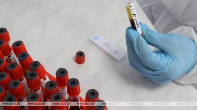 Белорусские ученые разработают комбинированный экспресс-тест для определения коронавируса и гриппа - belta.by - Белоруссия - Минск