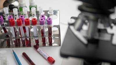 Показатель уровня антител в крови оказался главным для выживаемости при COVID-19 - inforeactor.ru - Канада - Испания