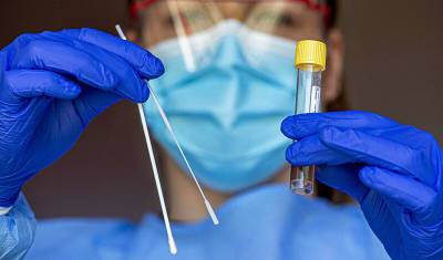 Ученые подтвердили: тест на антитела может не выявлять коронавирус - newizv.ru