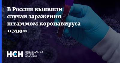 Василий Акимкин - В России выявили случаи заражения штаммом коронавируса «мю» - nsn.fm - Россия