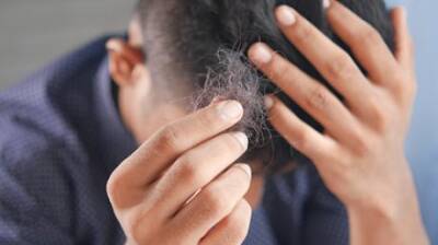 Наталья Шаманская - Российский врач назвала способы остановить выпадение волос после COVID-19 - penzainform.ru