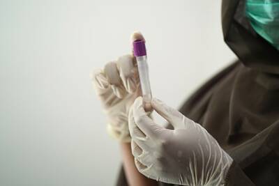 Российские медики пересчитают антитела к коронавирусу - lenta.ru