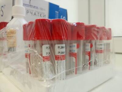 Ученые определили второго пациента с ВИЧ, организм которого избавился от вируса - ufacitynews.ru