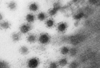 Ученые показали, как выглядит на фото дельта-коронавирус - online47.ru - Китай - Индия