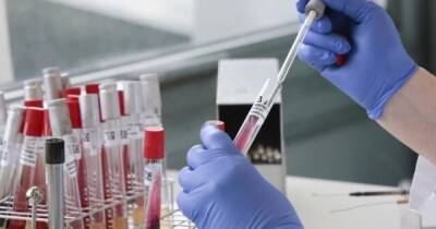 В Украине более 18 тысяч новых COVID-инфицированных - dsnews.ua - Украина