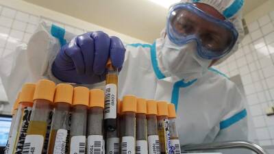 Сергей Нетесов - Врач назвал признаки полного выздоровления от коронавируса - iz.ru - Израиль