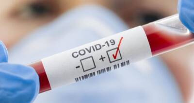 В Украине за сутки зафиксировано 14 325 новых случаев инфицирования COVID-19 - vchaspik.ua - Украина