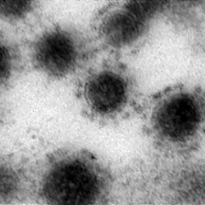Британские вирусологи сообщили о появлении нового штамма коронавируса - radiomayak.ru