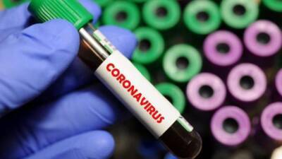 В ЮАР обнаружен новый вариант коронавируса - hubs.ua - Украина - Юар - Covid