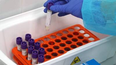 В Чехии выявили новый штамм коронавируса «Омикрон» - iz.ru - Египет - Израиль - Чехия