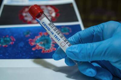 Эпидемиолог из ЮАР оценил опасность нового штамма коронавируса и мира - cursorinfo.co.il - Юар