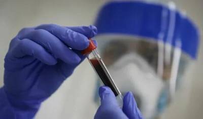 Американские ученые обнаружили антитело, способное противостоять коронавирусам - newizv.ru