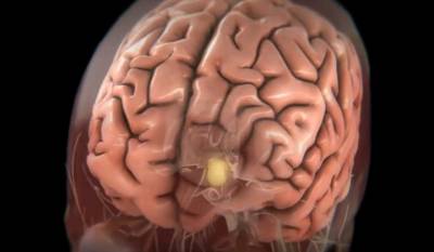 Ученые выяснили, что коронавирус не поражает клетки мозга - vm.ru - Сша - Германия - Бельгия
