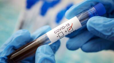 В Украине за сутки зафиксировано 10 554 новых случаев коронавируса - vchaspik.ua - Украина