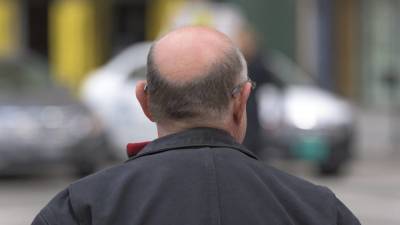 Выпадение волос стало частой жалобой россиян после перенесенного COVID-19 - inforeactor.ru