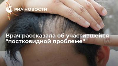 Елена Климкина - Врач Климкина рассказала, что пациенты все чаще жалуются на выпадение волос после COVID-19 - ria.ru - Россия - Москва
