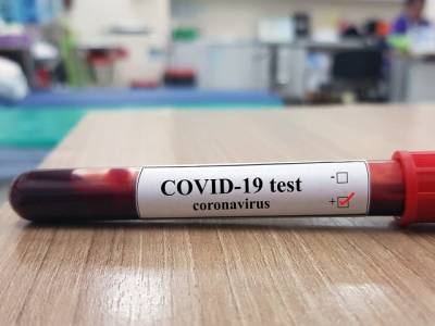 554 заболевших и 30 умерших: статистика по коронавирусу в Челябинской области - u24.ru - Челябинская обл.