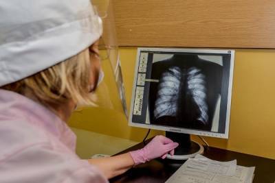 Рентгенолог предрёк исчезновение флюорографии как метода диагностики - govoritmoskva.ru - Москва