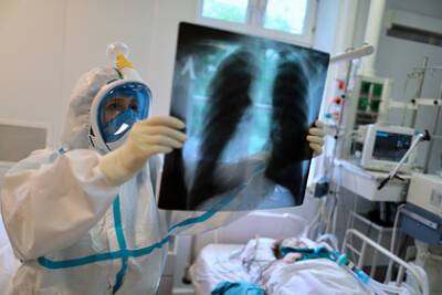 Пульмонолог назвала симптомы поражения легких при коронавирусе - lenta.ru - Россия