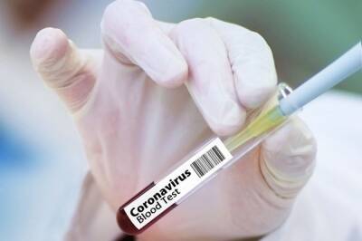 В России за последние сутки коронавирус подтвердился у 32 837 человек - aif.ru - Россия