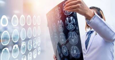 Ученые из России создали новый метод диагностики заболеваний мозга - ren.tv - Россия - Саратов