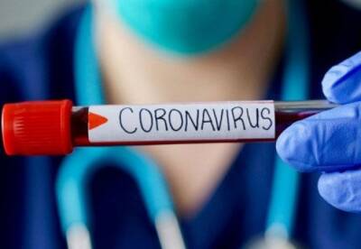 В Украине почти 9 тысяч новых случаев коронавируса - facenews.ua - Украина - Киев