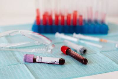 Аллерголог-иммунолог подставила под сомнение, что количество антител зависит от пола и возраста - spb.mk.ru