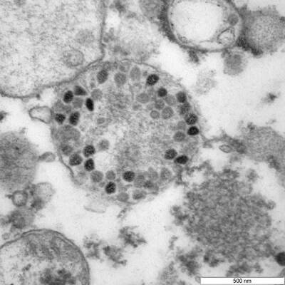 Российские вирусологи опубликовали фотографии нового омикрон-штамма коронавируса - znak.com