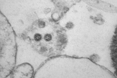 Учёные сфотографировали штамм коронавируса «омикрон» - tver.mk.ru