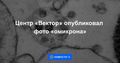 Центр «Вектор» опубликовал фото «омикрона» - news.mail.ru