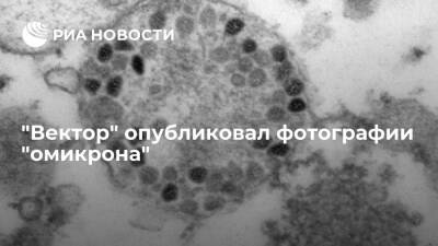 Центр "Вектор" опубликовал фотографии штамма коронавируса "омикрон" - ria.ru - Россия - Москва