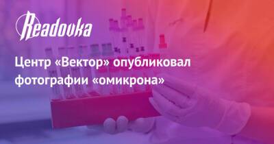 Центр «Вектор» опубликовал фотографии «омикрона» - readovka.ru