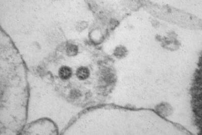 Как выглядят клетки, заражённые «омикроном»: фото учёных - chita.ru