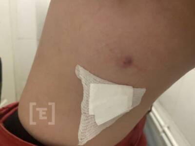 В Екатеринбурге женщину укололи иглой в автобусе. Она боится заболеть ВИЧ - znak.com - Екатеринбург