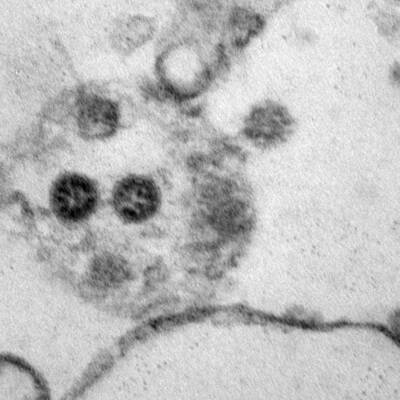 Омикрон-штамм коронавируса обнаружен уже в 110 странах - radiomayak.ru - Англия - Дания - Юар