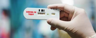 Российские ученые НМИЦ гематологии создали тест-систему на клеточный иммунитет к COVID-19 - runews24.ru
