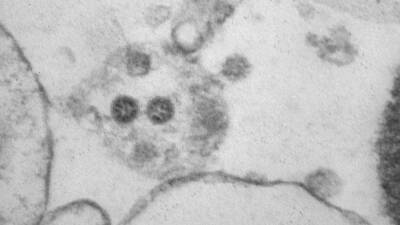 Research Square: вирус SARS-CoV-2 может сохраняться в организме в течение многих месяцев - inforeactor.ru